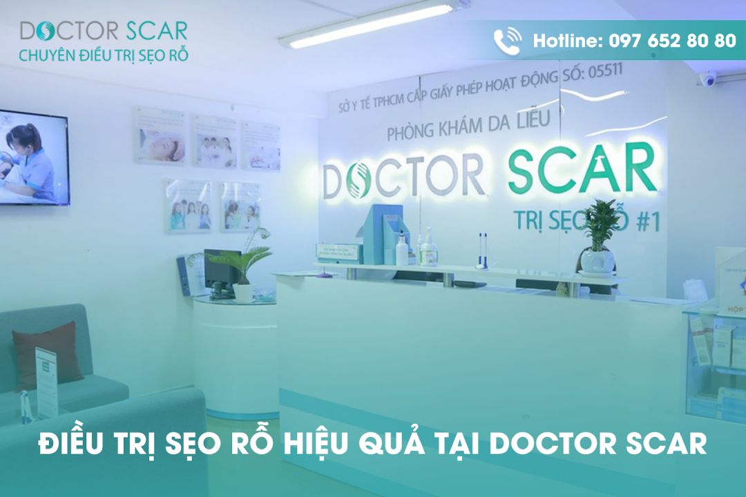 quy trình điều trị sẹo rỗ tại doctor scar