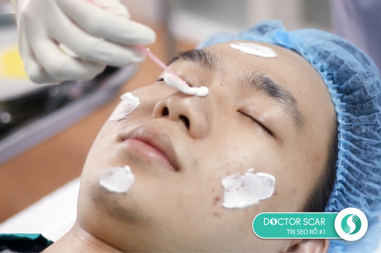 quy-trinh-tri-seo-ro-bang-laser