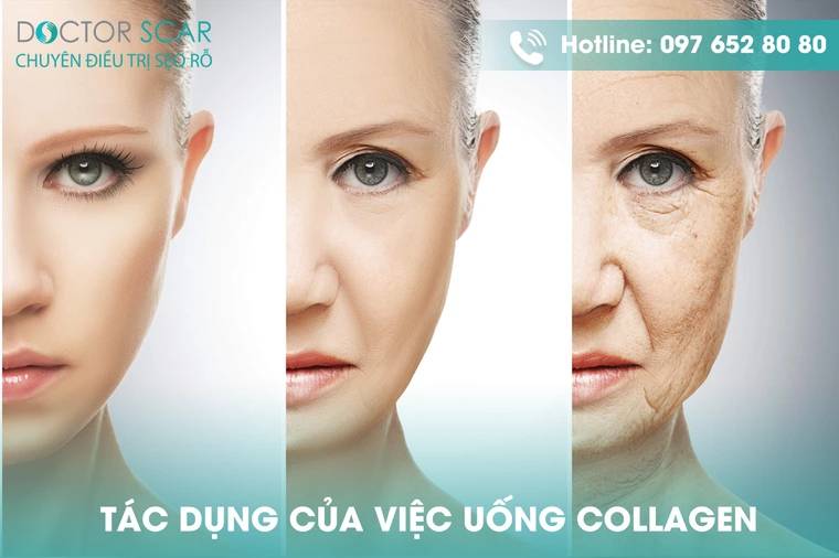 Sau lăn kim có nên uống collagen không