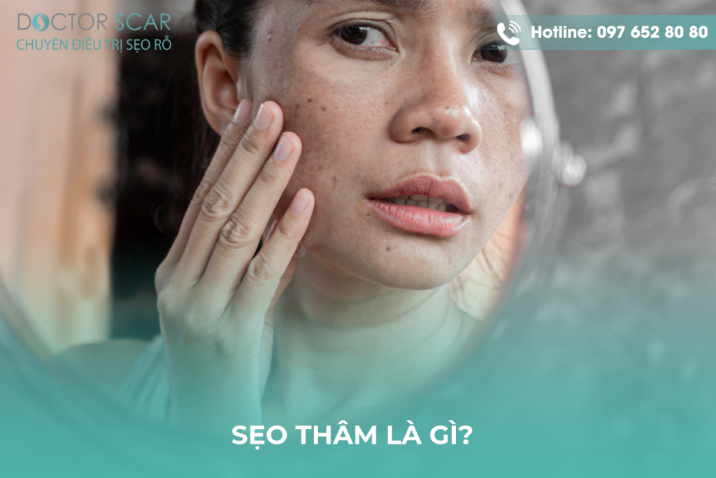 Sẹo thâm là gì?