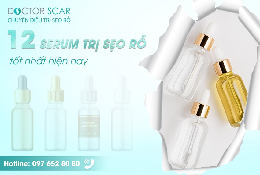 Serum trị sẹo rỗ là gì? các loại serum lấp đầy sẹo rỗ tốt hiện nay