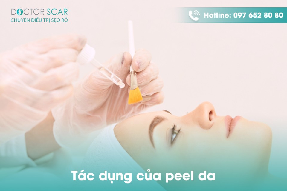 peel da là gì? tác dụng của peel da bạn nên biết trong làm đẹp