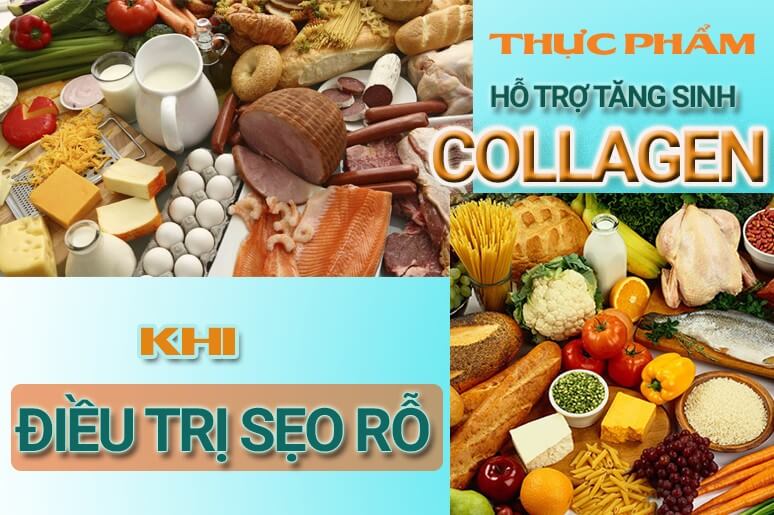 tăng sinh collagen trị sẹo rỗ bằng chế độ ăn uống hằng ngày