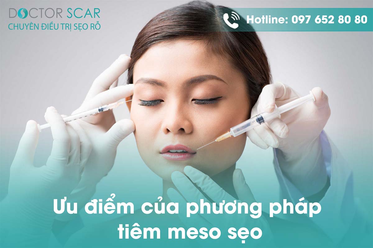 ưu điểm khi tiêm meso trị sẹo rỗ