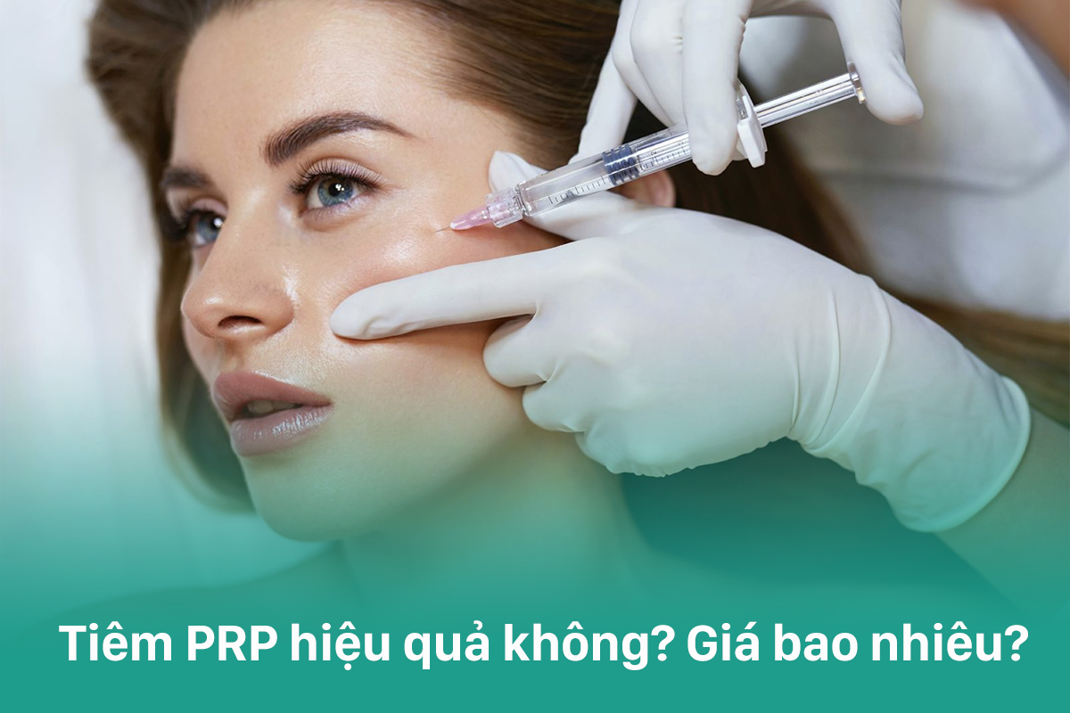 tiêm prp giá bao nhiêu, có hiệu quả không