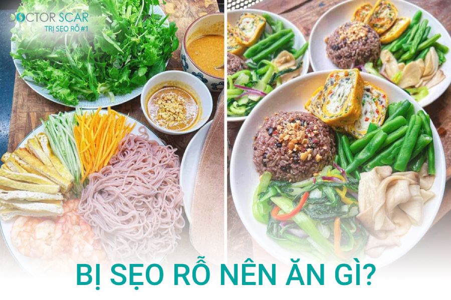 bị sẹo rỗ đáy tròn lên ăn gì và kiêng gì