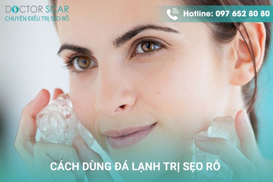 Cách sử dụng đá lạnh trị sẹo rỗ và chăm sóc da.