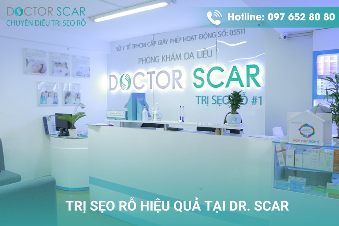 Điều trị sẹo rỗ tại doctor Scar