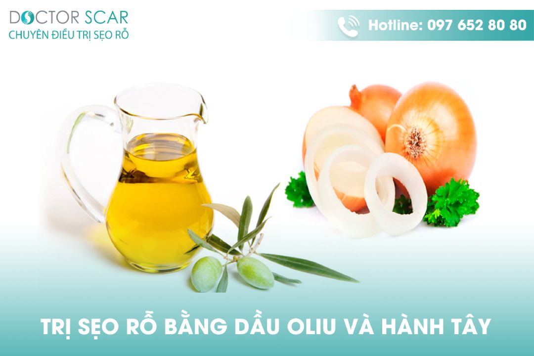 Trị sẹo rỗ bằng dầu oliu và hành tây