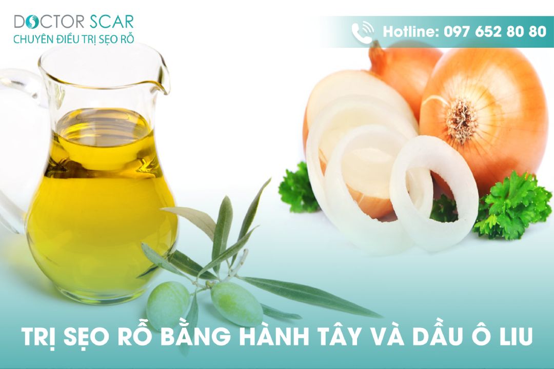 Cách dùng nước ép hành tây và dầu oliu trị sẹo rỗ