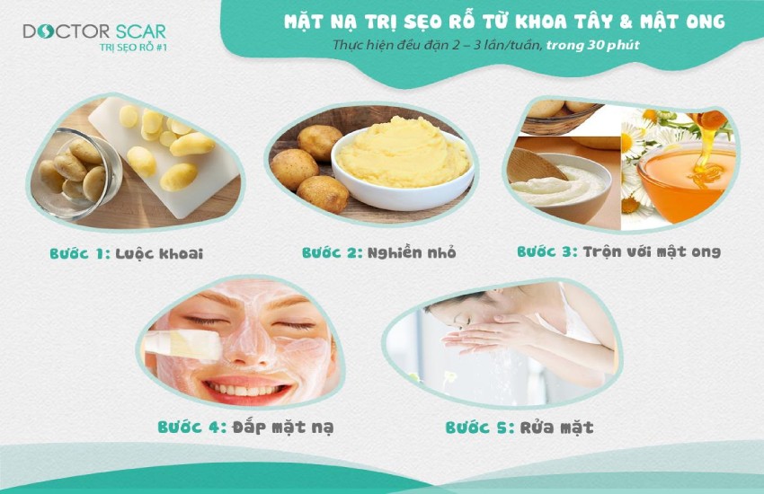 Cách trị sẹo lõm lâu năm tại nhà bằng khoai tây và mật ong