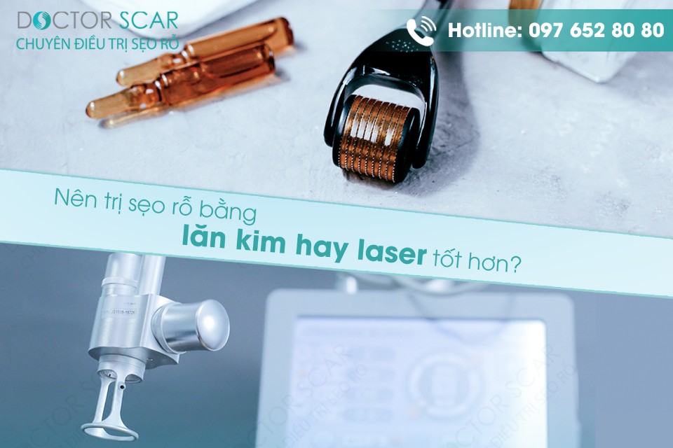 trị sẹo rỗ bằng lăn kim hay laser tốt hơn