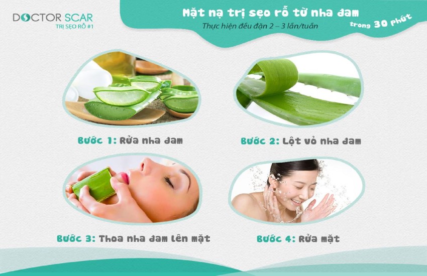 Cách trị sẹo rỗ lâu năm bằng nha đam