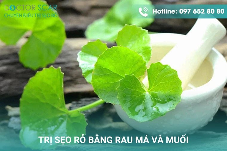 trị sẹo rỗ bằng rau má và muối