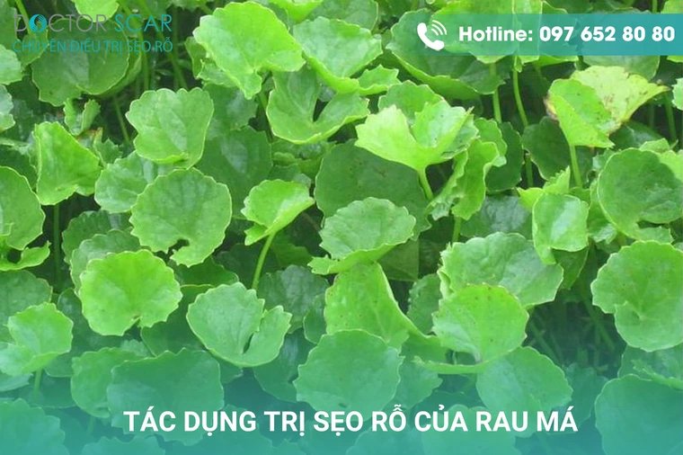 Tác dụng trị sẹo rỗ của rau má.