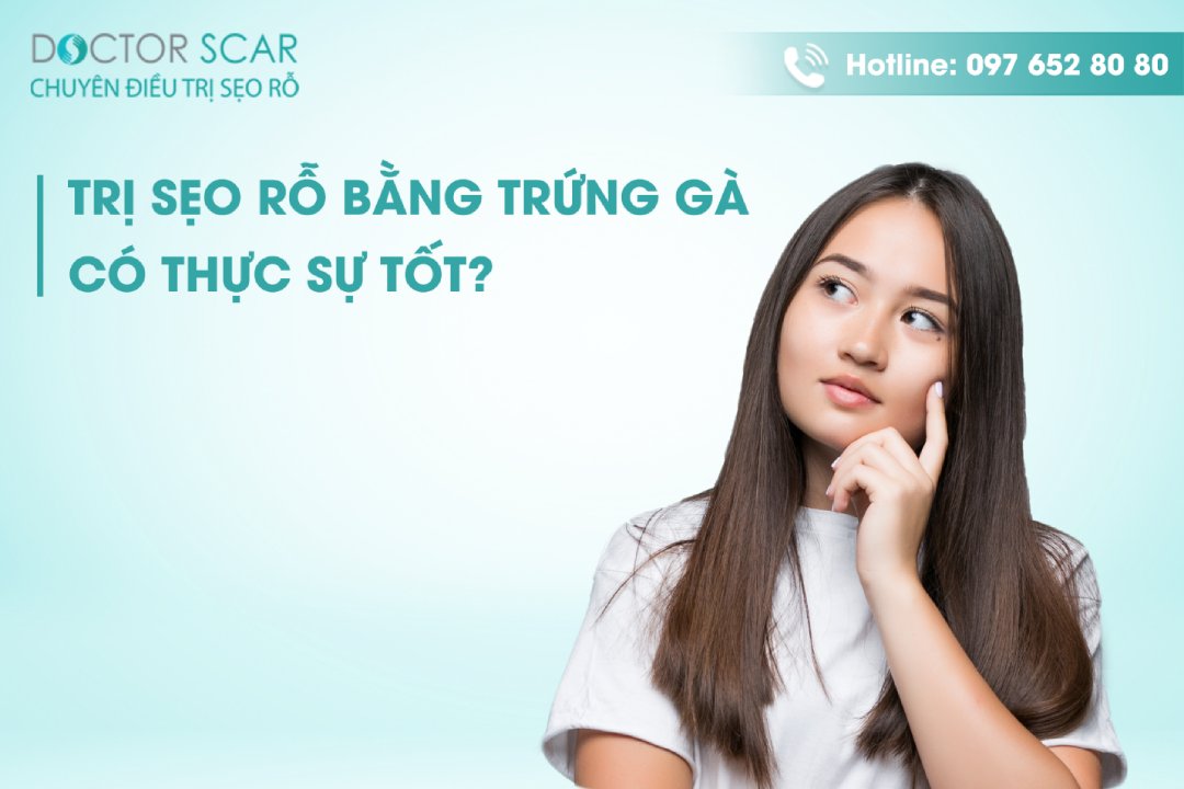 trị sẹo rỗ bằng trứng gà có thực sự tốt như đồn?