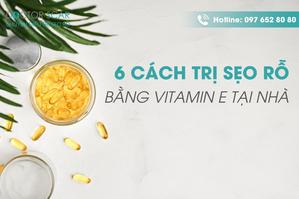 Cách trị sẹo rỗ bằng vitamin E