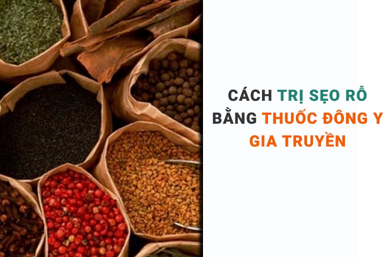 trị sẹo rỗ lâu năm tại nhà bằng thuốc đông y gia truyền