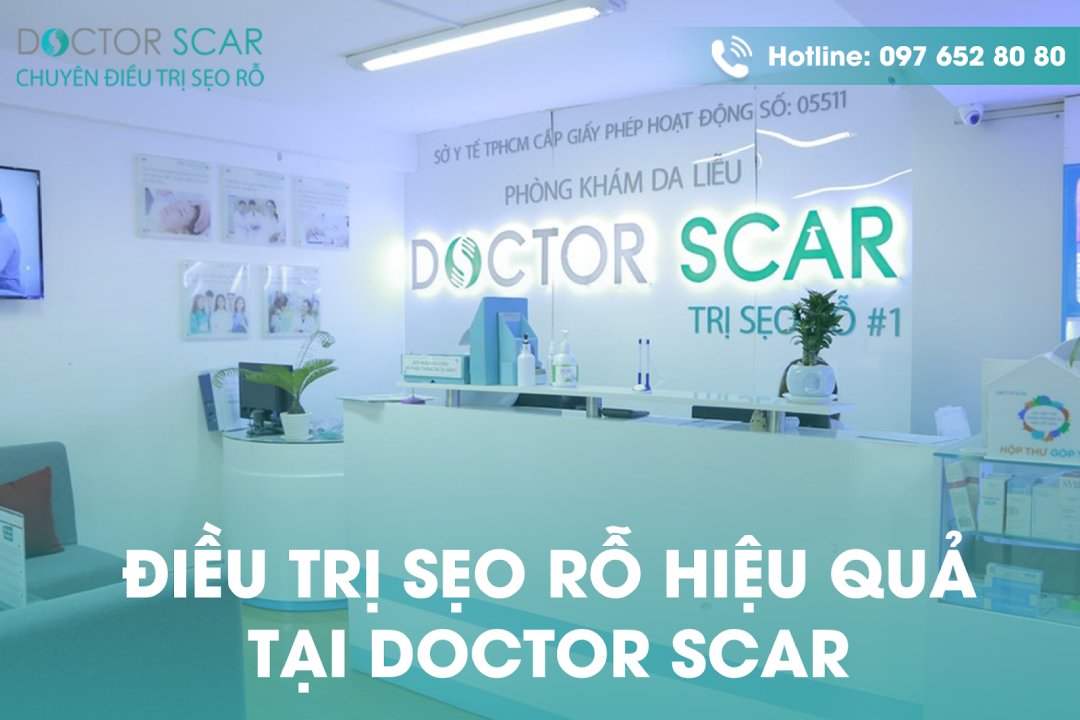 điều trị sẹo rỗ tại phòng khám da liễu doctor scar