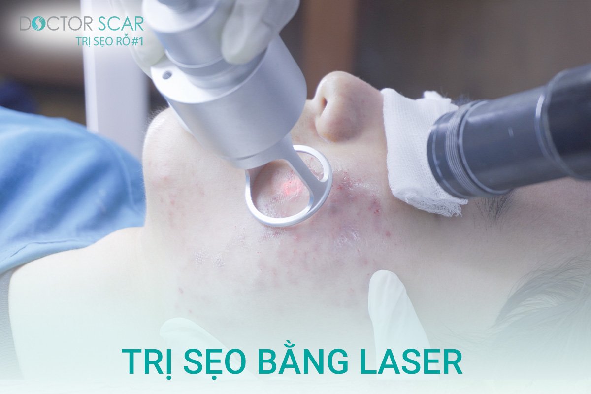 Trị sẹo tai nạn bằng phương pháp laser