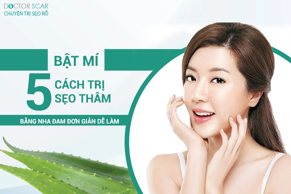 5 cách trị sẹo thâm bằng nha đam