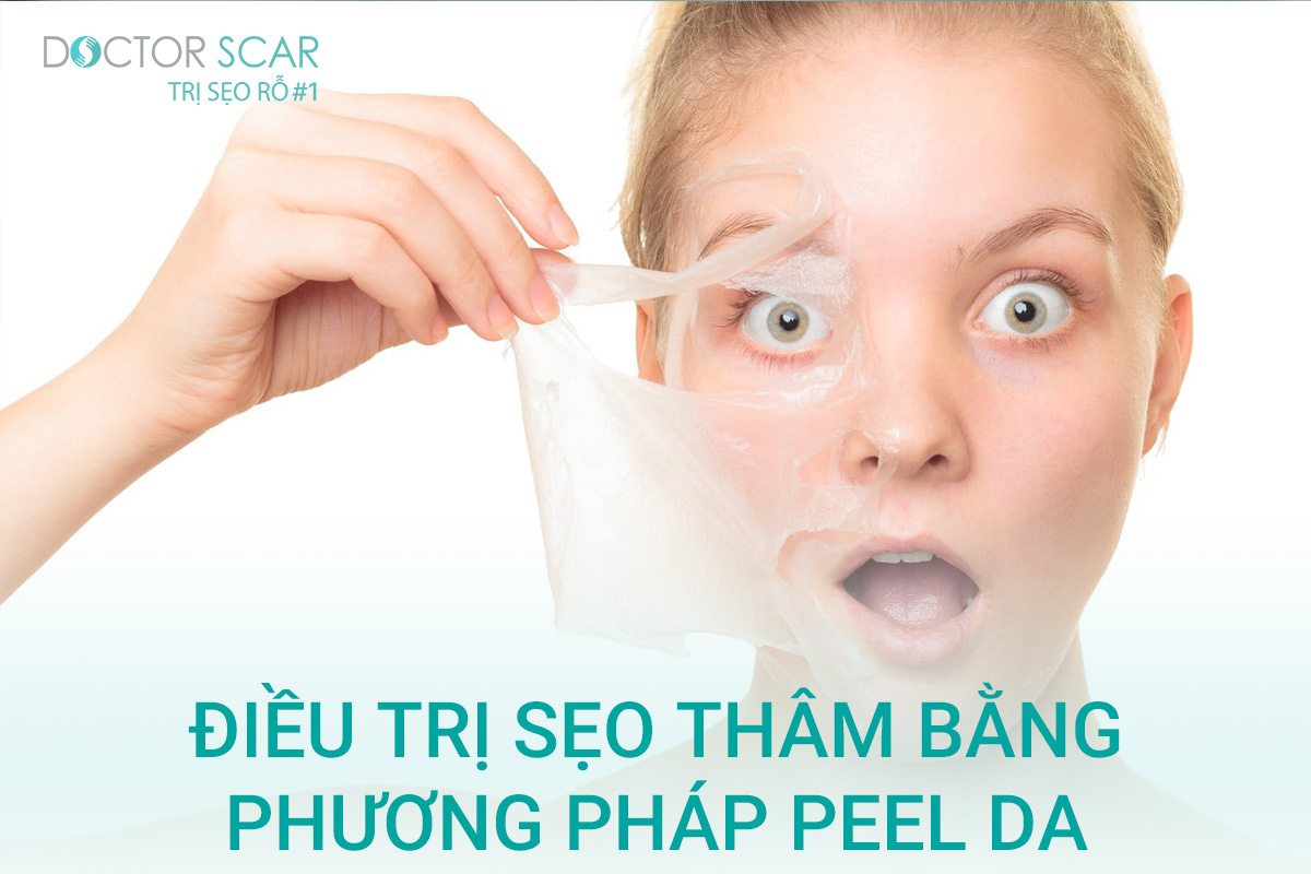 Trị sẹo thâm sau tai nạn bằng peel da