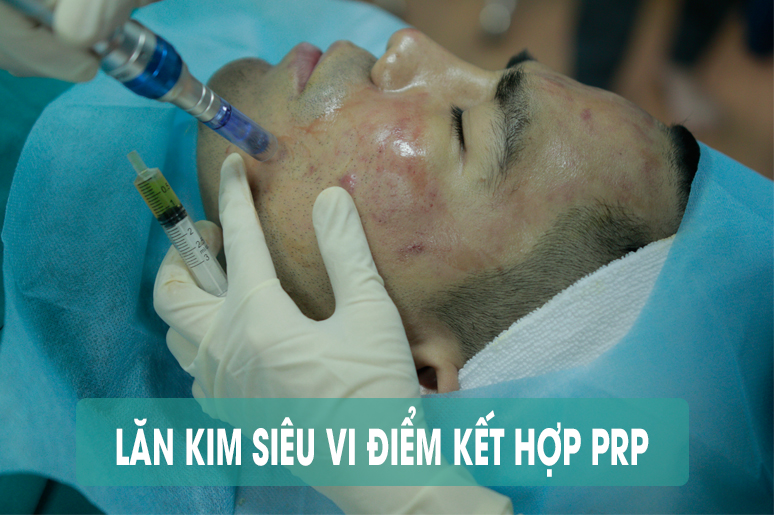 ung-dung-cua-lan-kim-prp-trong-dieu-tri-seo-ro