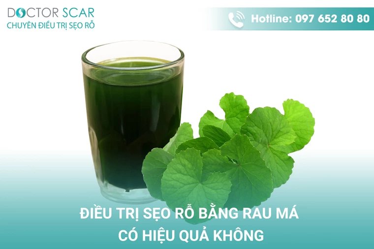 Điều trị sẹo rỗ bằng rau má có hiệu quả không