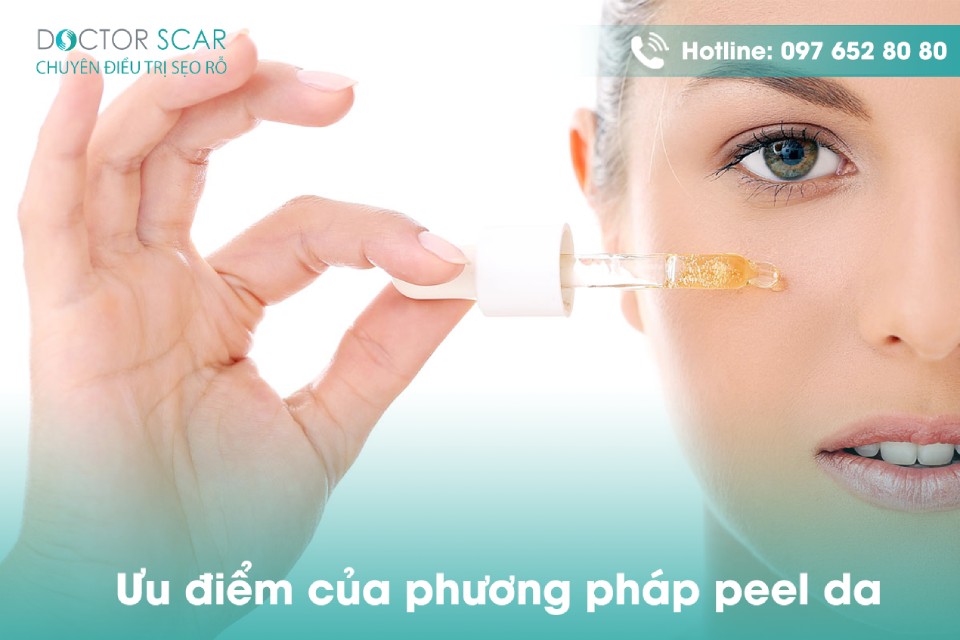 Ưu và nhược điểm của phương pháp peel da