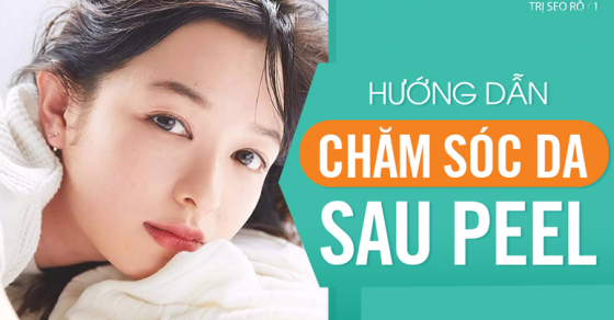 Hướng dẫn chi tiết cách chăm sóc da sau Peel hiệu quả