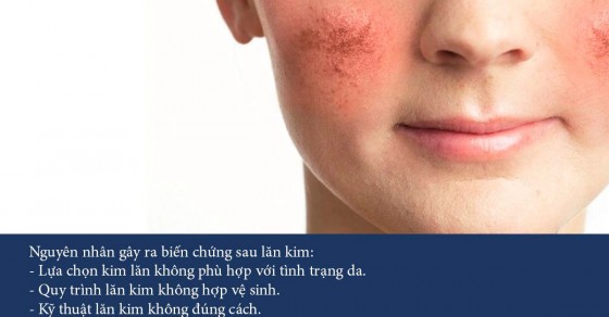 cách đẩy nhanh quá trình tái tạo da
