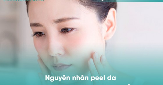 Nguyên nhân peel da nhưng không bong tróc và cách khắc phục