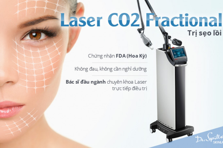 Cách tốt nhất trị sẹo lõm : máy Laser Fractional CO2