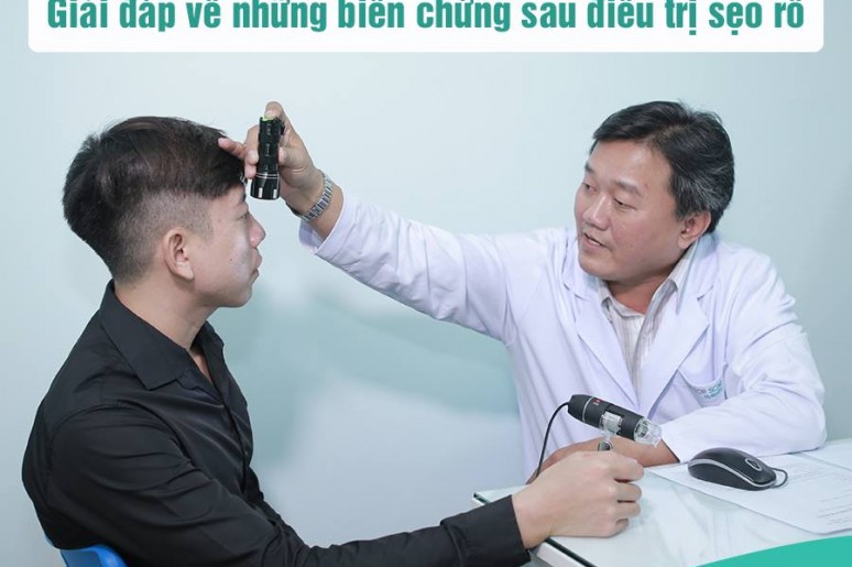 Hỏi - đáp về những tác dụng phụ sau điều trị sẹo rỗ bằng Laser Fractional CO2