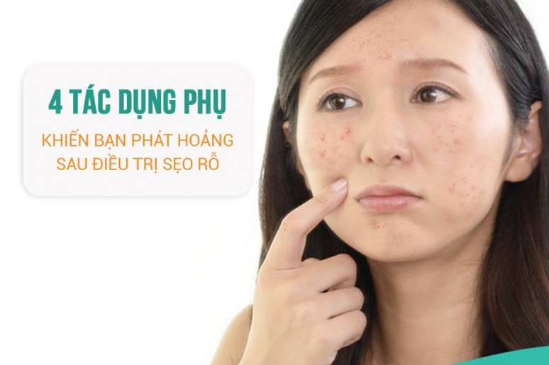 4 tác dụng phụ sau điều trị sẹo rỗ thường khiến bạn phát hoảng