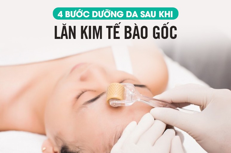 Bí quyết chăm sóc da sau lăn kim tế bào gốc chuẩn 3-4-7