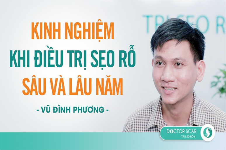 Chàng trai điều trị sẹo rỗ 4 lần, cải thiện hơn 90%