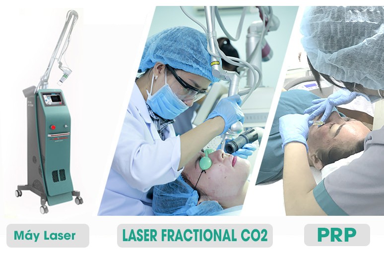 7 lưu ý quan trọng để trị sẹo hiệu quả bằng công nghệ Laser Fractional CO2