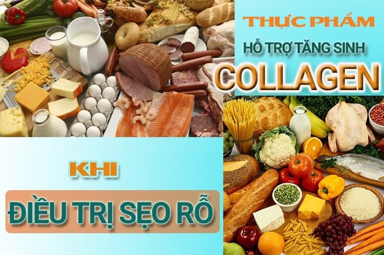 Thuốc uống và các cách hỗ trợ tăng sinh collagen khi trị sẹo rỗ