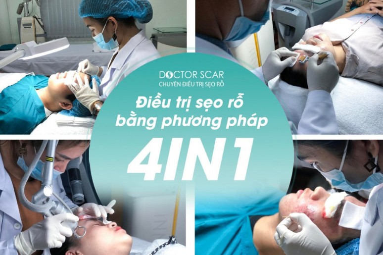 DoctorScar - Chuyên trị sẹo rỗ