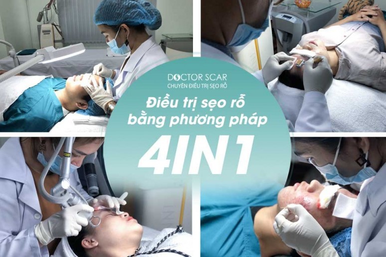 DoctorScar - Chuyên trị sẹo rỗ