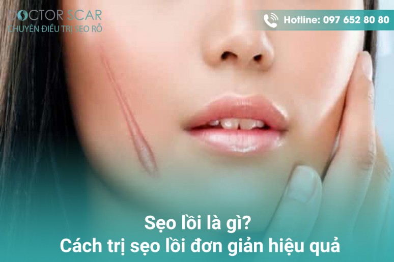 DoctorScar - Chuyên trị sẹo rỗ