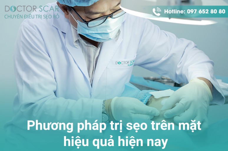 Bí quyết để trị sẹo trên mặt thành công nhưng ít ai biết đến