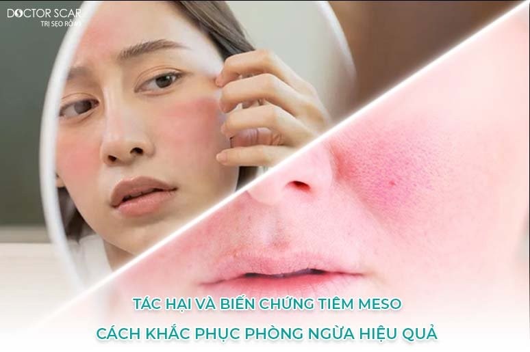 6 Tác hại của tiêm meso thường gặp mọi người thường chủ quan